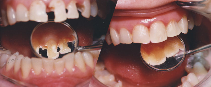 Konzervativna stomatologija i endodoncija